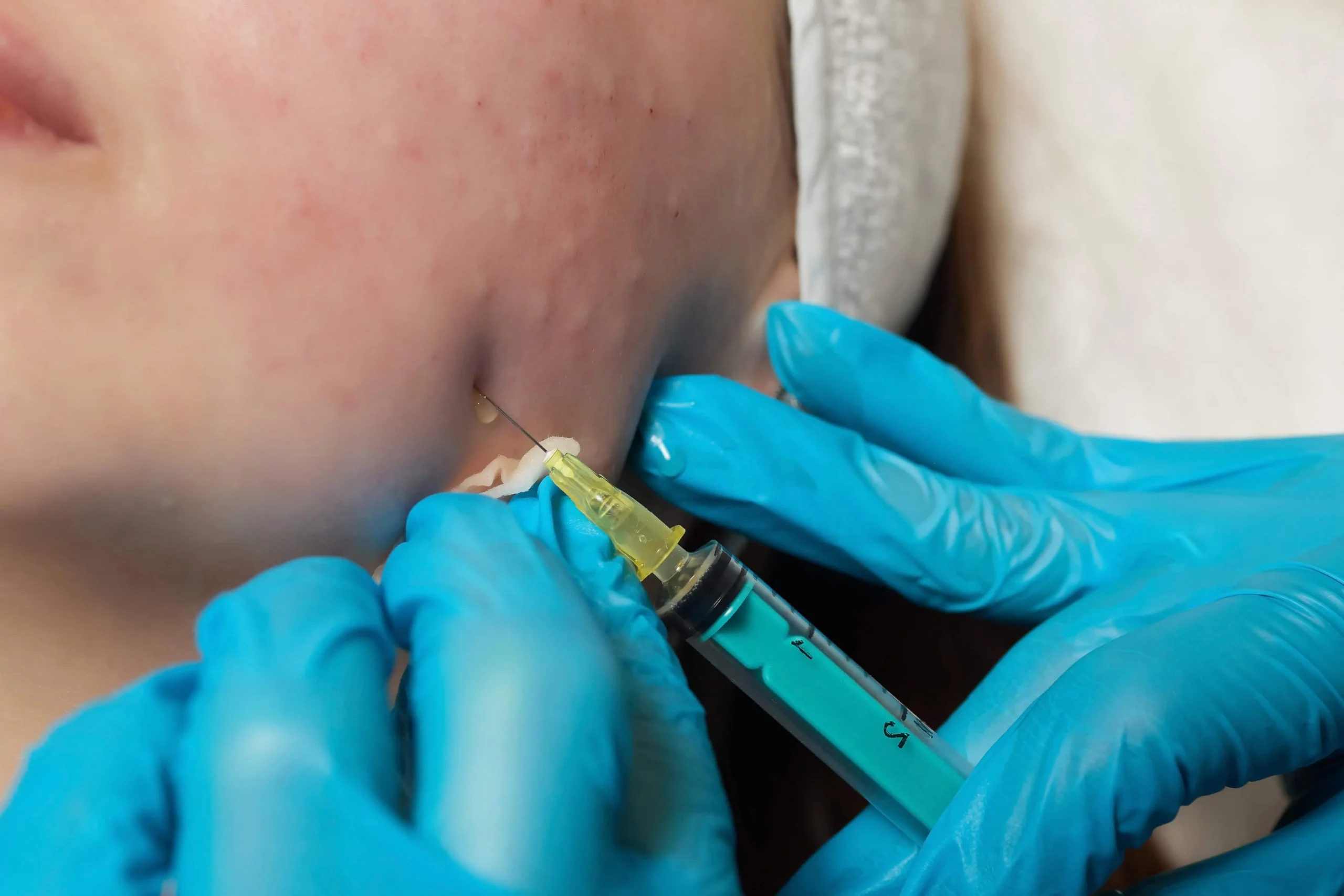 Anti-Aging Tampa image 1