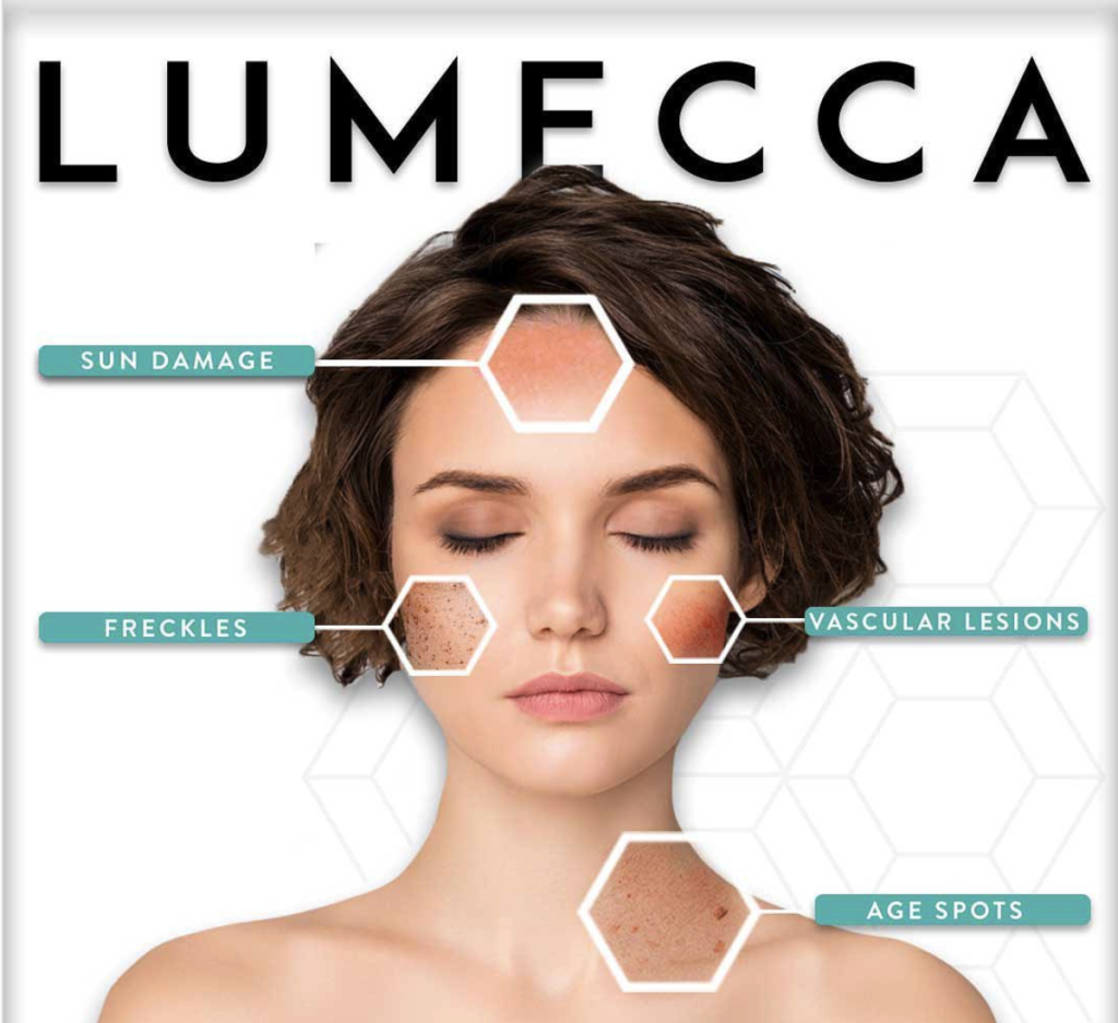 Dark Spots Tampa image 1